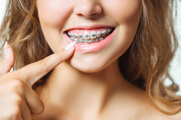Jak wybrać najlepszego ortodontę w Tychach?